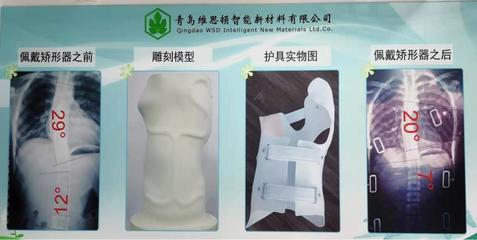 拯(zheng)救(jiu)&ldquo;維(wei)納斯(si)&rdquo; 「維思頓(dun)」開(kai)創數字化仿真智(zhi)能矯形